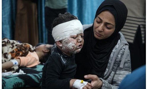 EUROVISION'DA SOYKIRIMA SAHNE YOK